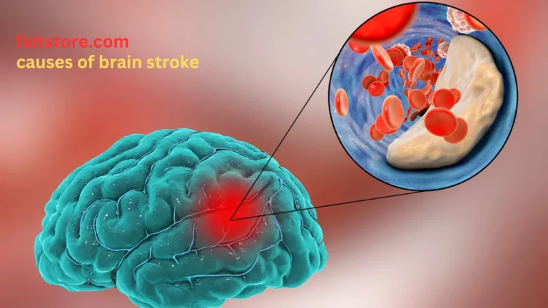 causes of brain stroke