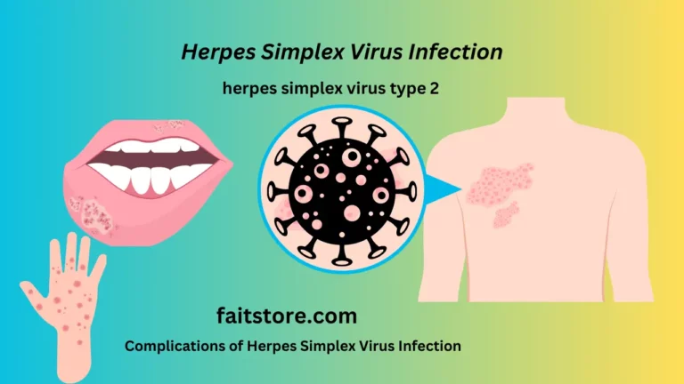 herpes simplex virus infection