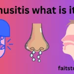 sinusitis what is it