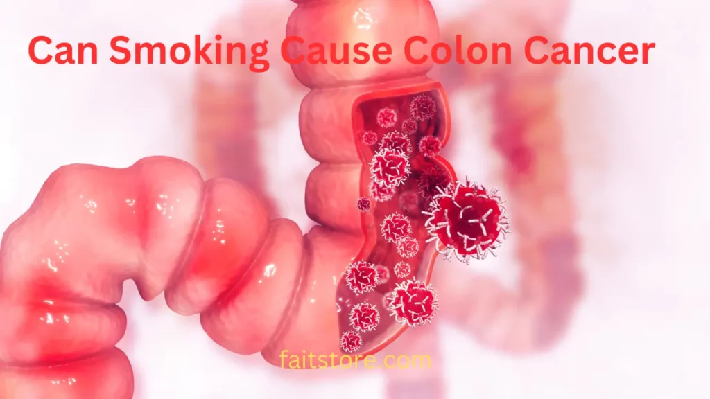 can smoking cause colon cancer