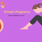 ectopic pregnancy stories